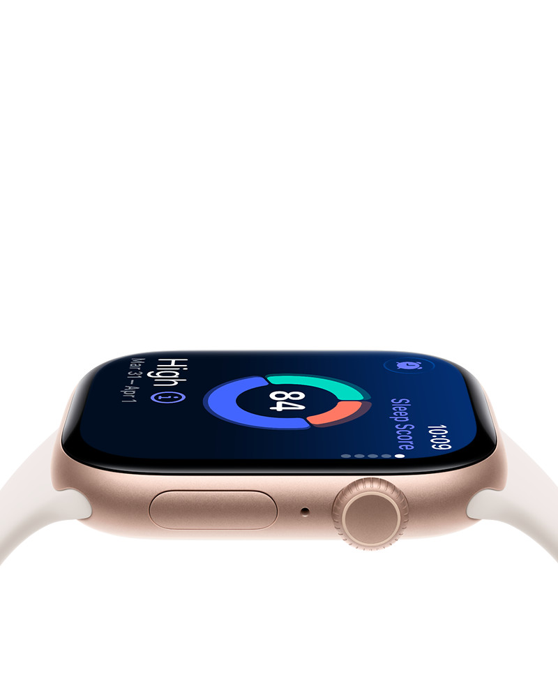 Apple Watch Series 11 internetu pigiau. Iki 24 mėn. lizingas be pabrangimo.